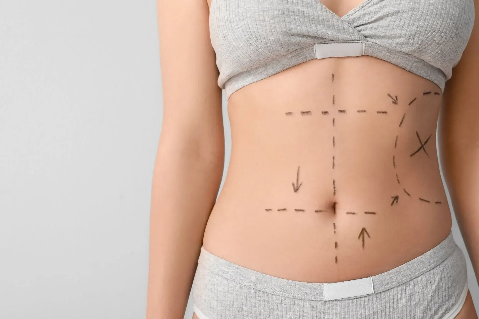 Cirurgia plástica estética x reparadora: conheça a diferença entre elas